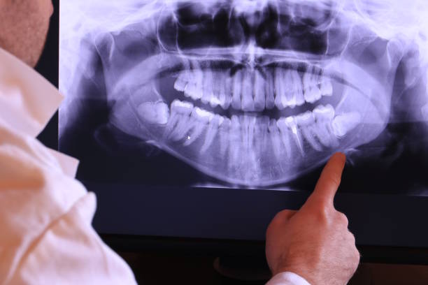 Best Pediatric Emergency Dentist in Warren, MN