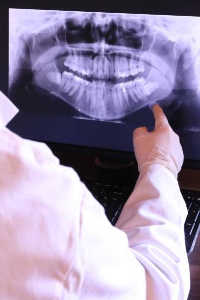 Best Emergency Tooth Extraction in Warren, MN