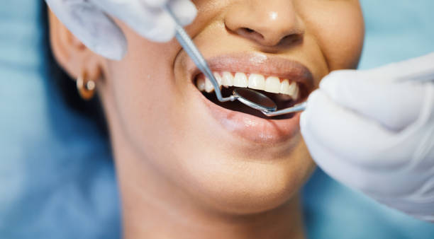 Best Emergency Root Canal Treatment in Warren, MN